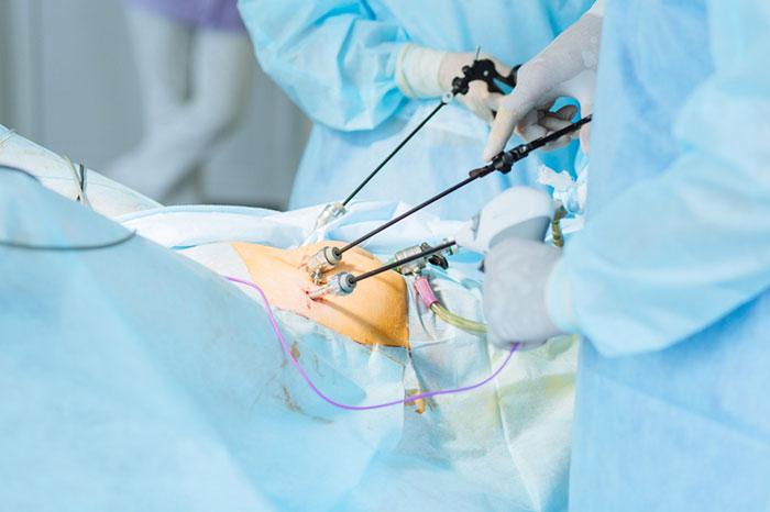 Best Uterus Removal Surgeon in Indore