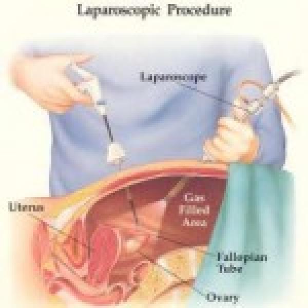Best Laparoscopic Surgeon in Indore